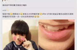 牙齿娱乐,揭秘口腔健康与快乐生活的完美融合